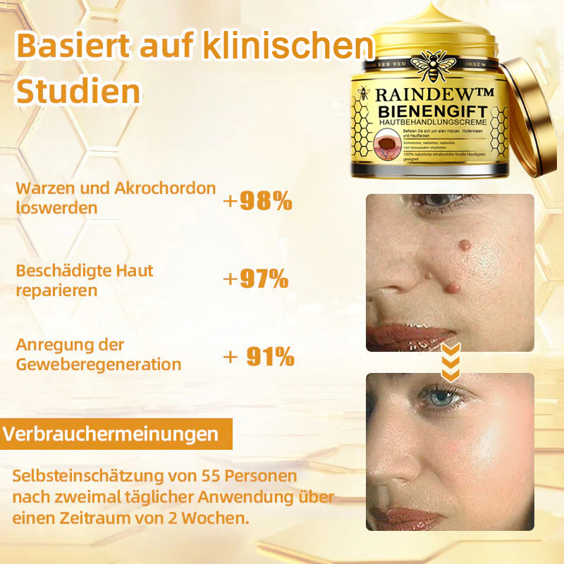 [Winter-Hautpflege] Raindew™Bienengift-Hautpflegecreme (AAD Empfohlen)