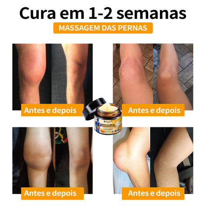 Ropceer™ Bee Venom Instant Ultra Pain Relief Healing Cream - (✅Proporciona a eliminação da dor para artrite, músculos, dores nas costas, joelhos, costas, ombros, ancas, pulsos, mãos)