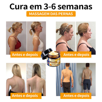 Ropceer™ Bee Venom Instant Ultra Pain Relief Healing Cream - (✅Proporciona a eliminação da dor para artrite, músculos, dores nas costas, joelhos, costas, ombros, ancas, pulsos, mãos)