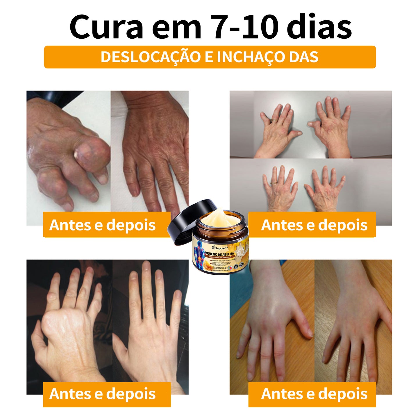 Ropceer™ Bee Venom Instant Ultra Pain Relief Healing Cream - (✅Proporciona a eliminação da dor para artrite, músculos, dores nas costas, joelhos, costas, ombros, ancas, pulsos, mãos)