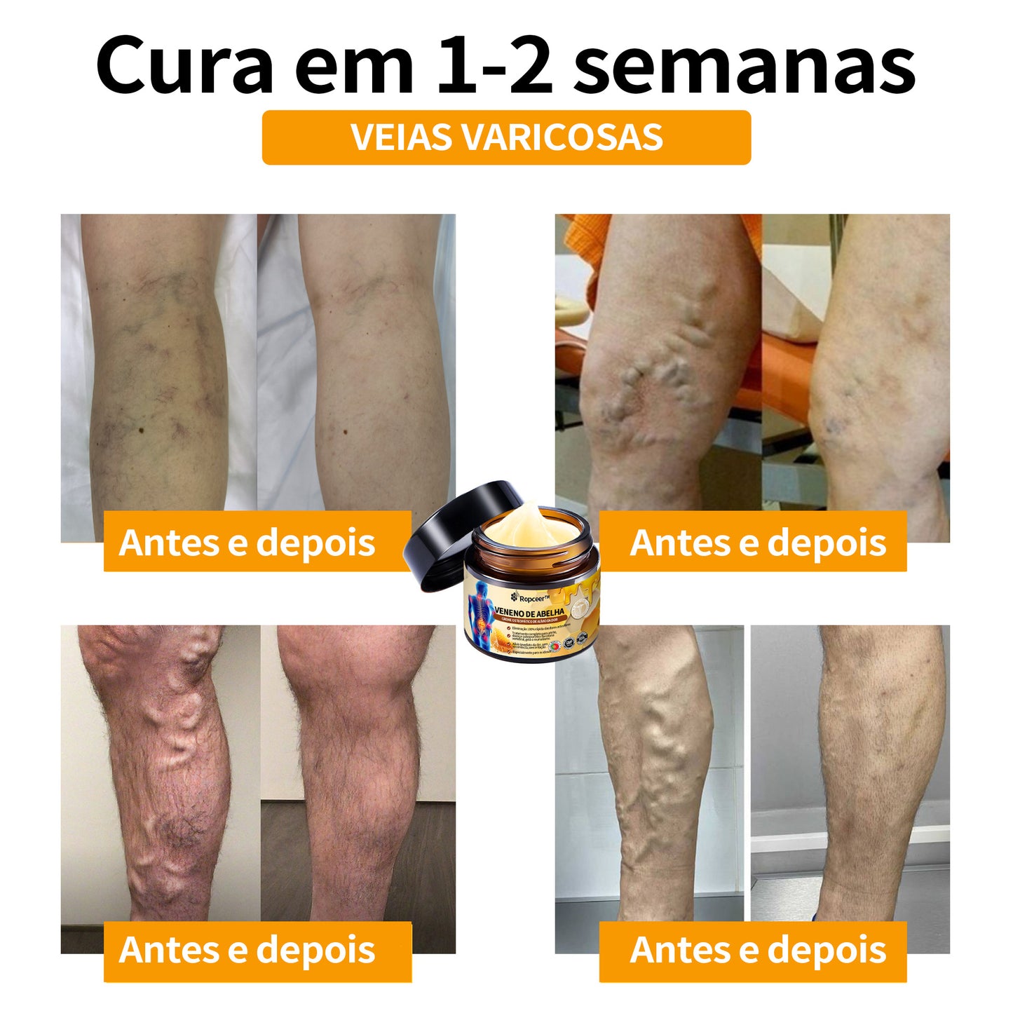 Ropceer™ Bee Venom Instant Ultra Pain Relief Healing Cream - (✅Proporciona a eliminação da dor para artrite, músculos, dores nas costas, joelhos, costas, ombros, ancas, pulsos, mãos)